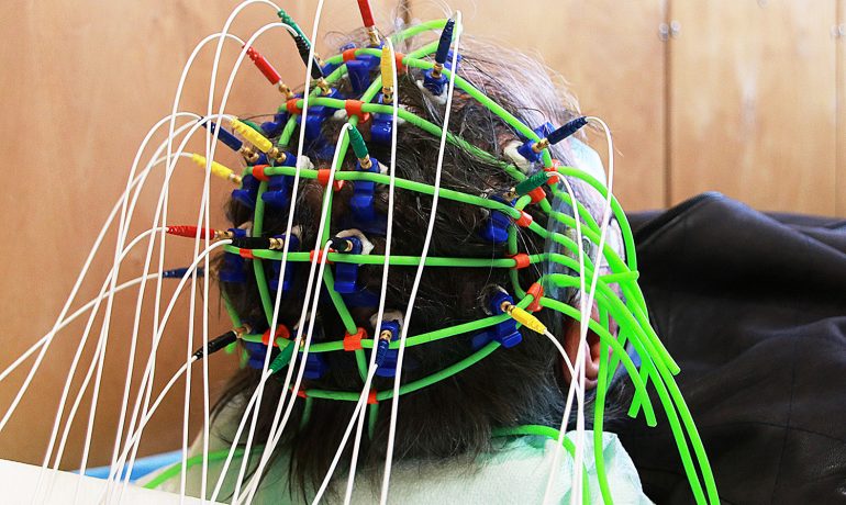 Zdjęcię przedstawia pacjenta podczas badania EEG oraz elektrody umieszczone na skórze głowy